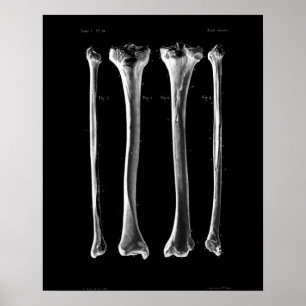 1844 Vintage Anatomy Print Tibia Fibula