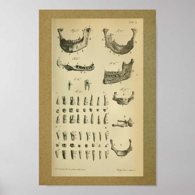 1850 Vintage Anatomy Print Jaw Teeth (Front)