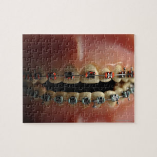 A dental model and Teeth braces Jigsaw Puzzle
