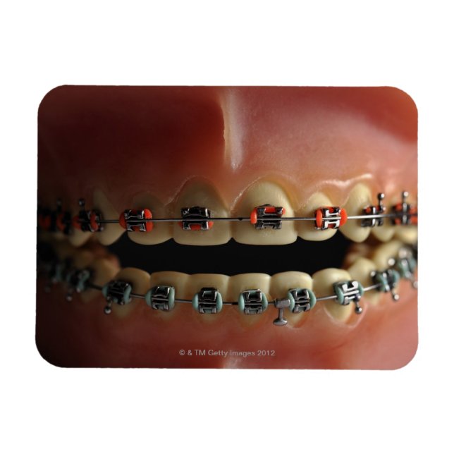 A dental model and Teeth braces Magnet (Horizontal)
