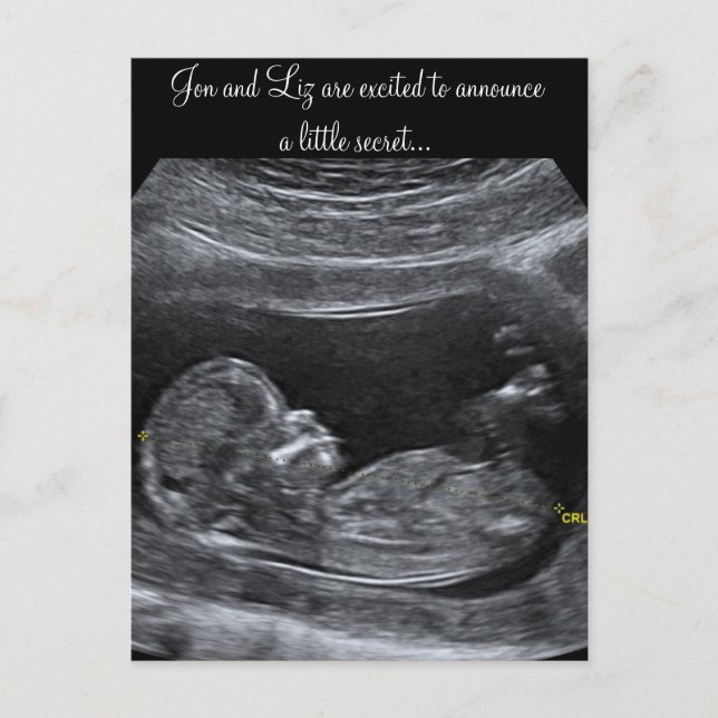 A Little Secret ~ Pregnancy Announcement (Front)