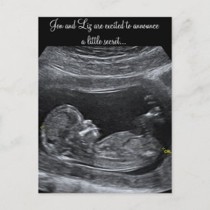 A Little Secret ~ Pregnancy Announcement Postcard