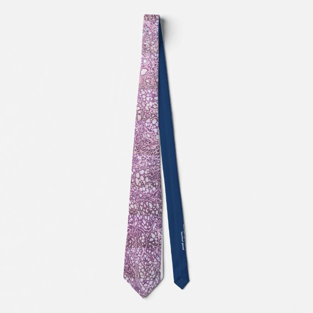 Adenoid cystic carcinoma lacrimal gland tie (Front)