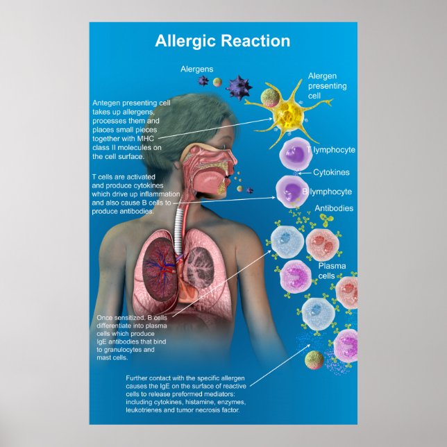 Affiche de réaction allergique (Devant)