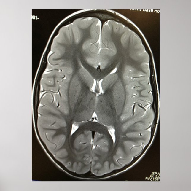 Affiche du cerveau IRM (Devant)