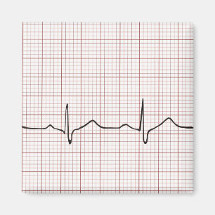 Aimant Brise cardiaque EKG sur papier graphique, pouls Ph