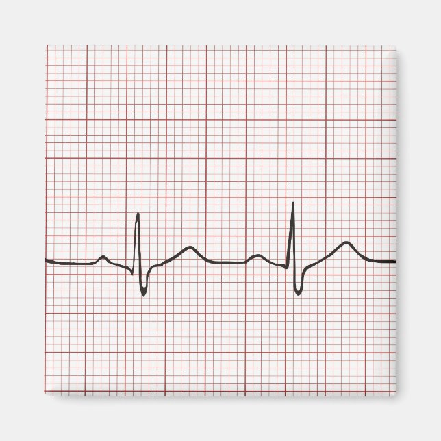Aimant Brise cardiaque EKG sur papier graphique, pouls Ph (Devant)