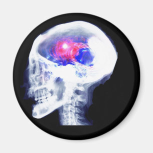 Aimant Cerveau de cyborg