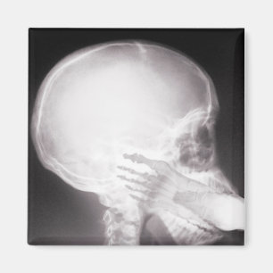 Aimant Foot à Mouth X-Ray
