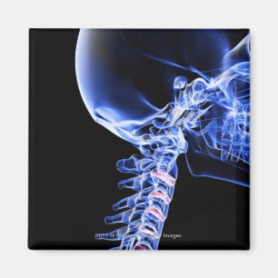 Aimant Image par rayons X des os du cou