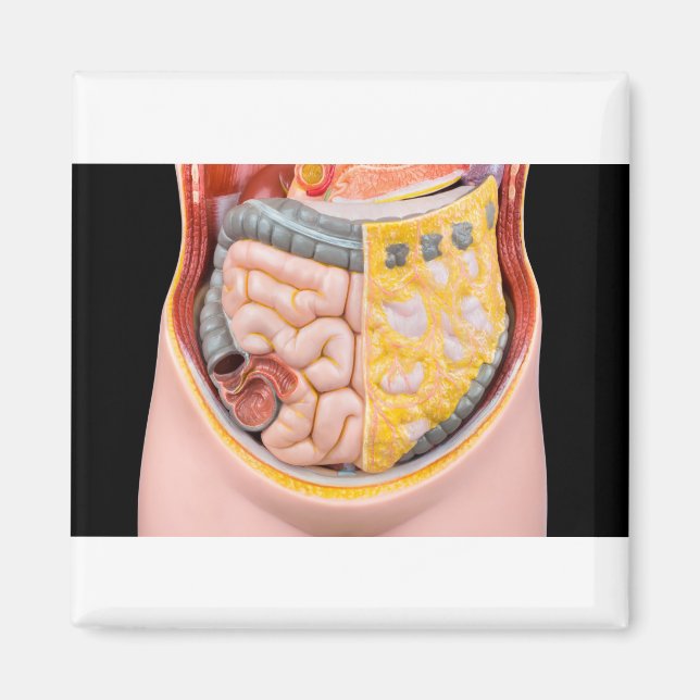 Aimant Modèle de l'abdomen humain avec intestins (Devant)