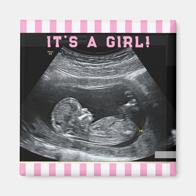 Aimant Première photo de bébé (Devant)