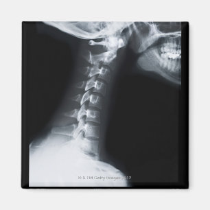 Aimant Rayon X des vertèbres du cou, y compris la mâchoir