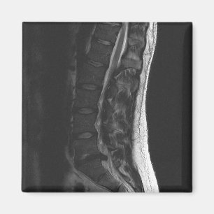 Aimant rompu de disque