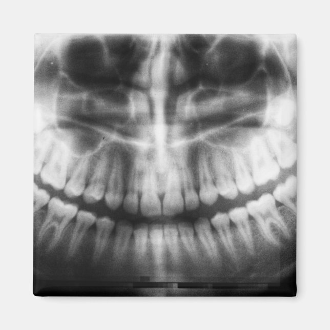 Aimant X-Ray Teeth Bouche sourire noir et blanc (Devant)