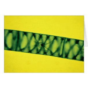 Algues vertes de Spirogyra
