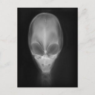 Alien Skull X-ray Postcard