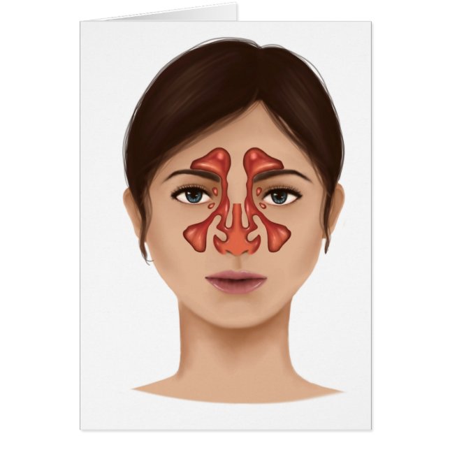 Anatomie Des Sinus Nasaux (Devant)