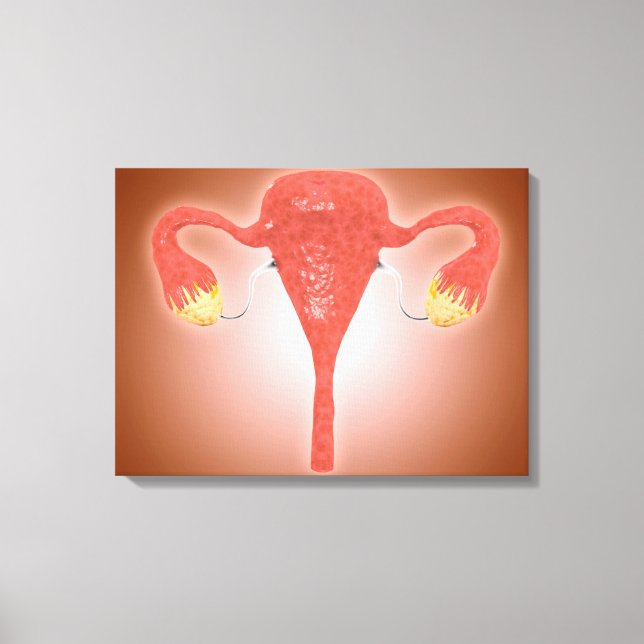 Anatomy Of Female Uterus With Ovaries Canvas Print (Front)