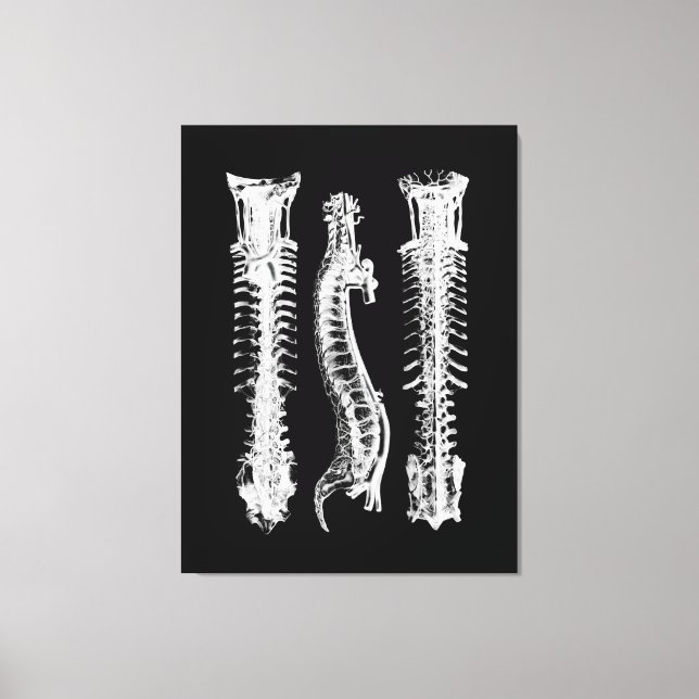 Anatomy of Human Spine Large Canvas Art (Front)