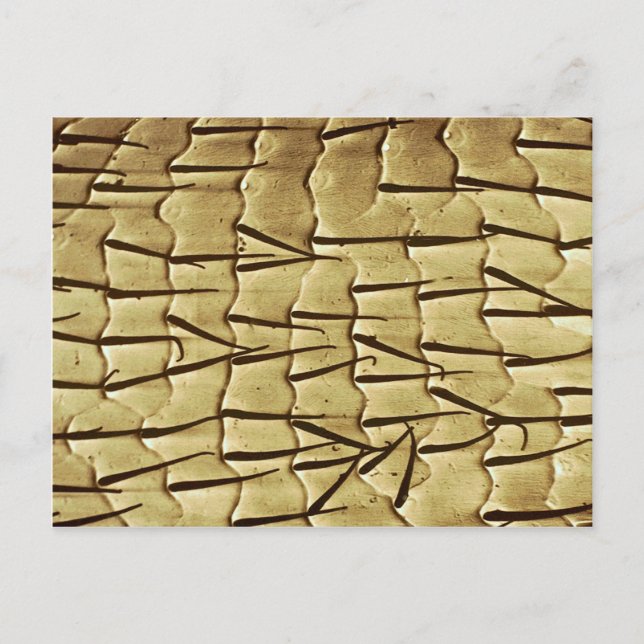 Ant - front leg postcard (Front)