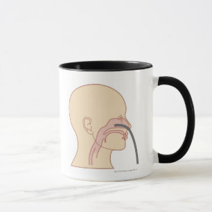 Anterior Rhinoscopy Mug