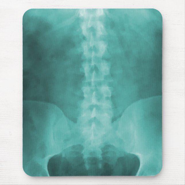 Aqua Digital X-Ray Art Mousepad (Front)