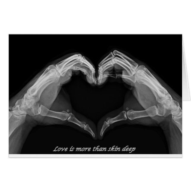 Art de rayon X (Devant horizontal)