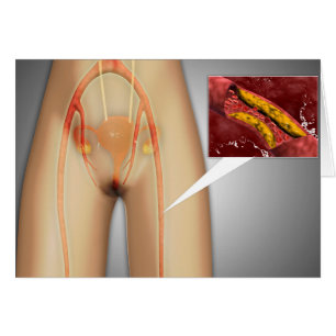 Artère étroite près de la jambe Gros plan