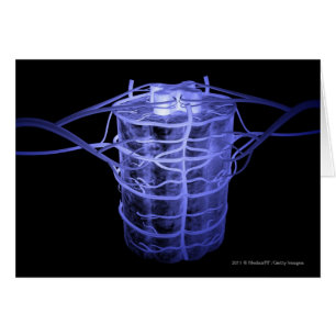 Artères entourant une partie de la colonne