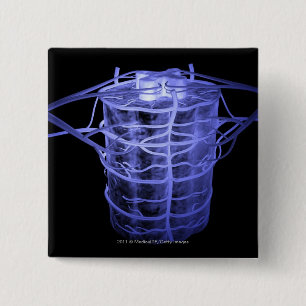 Arteries surrounding part of the spinal column 2 inch square button