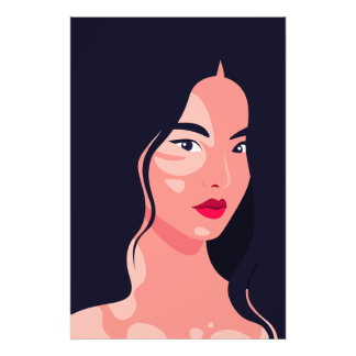 Asian Woman Portrait Vitiligo Beauty Vector  Photo Print