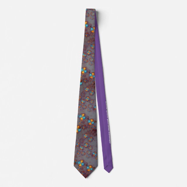 Asteroid hyalosis (polarization microscopy) tie (Front)