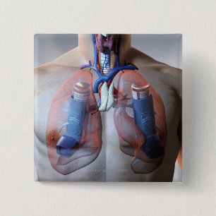 Asthma 2 Inch Square Button