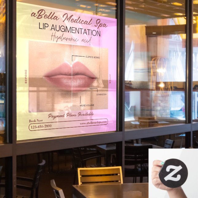 Autocollant Pour Fenêtre Personnaliser Med Spa Lip Augmentation Lip Remplis (Fenêtre du restaurant)