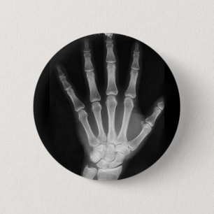 B&W X-ray Skeleton Hand 2 Inch Round Button