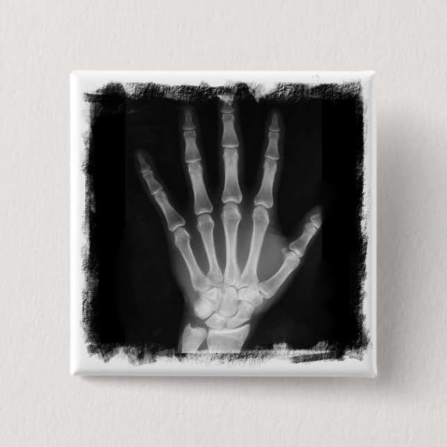 B&W X-ray Skeleton Hand 2 Inch Square Button (Front)