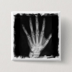B&W X-ray Skeleton Hand 2 Inch Square Button