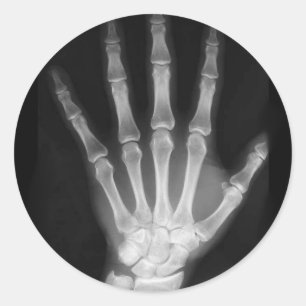 B&W X-ray Skeleton Hand Classic Round Sticker