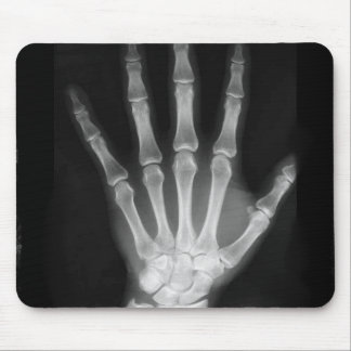 B&W X-ray Skeleton Hand Mouse Pad