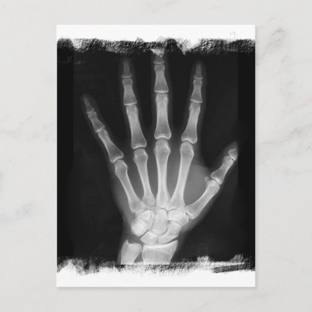 B&W X-ray Skeleton Hand Postcard (Front)