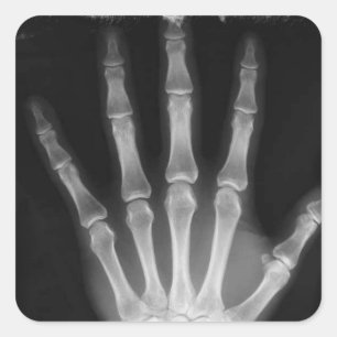 B&W X-ray Skeleton Hand Square Sticker