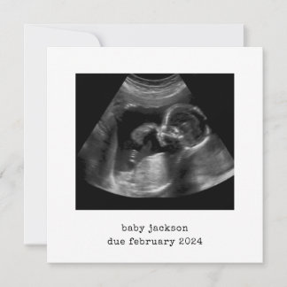 Baby Scan Photo Announcement Card