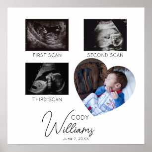  Baby Scan Photo sonogram newborn baby keepsake Poster