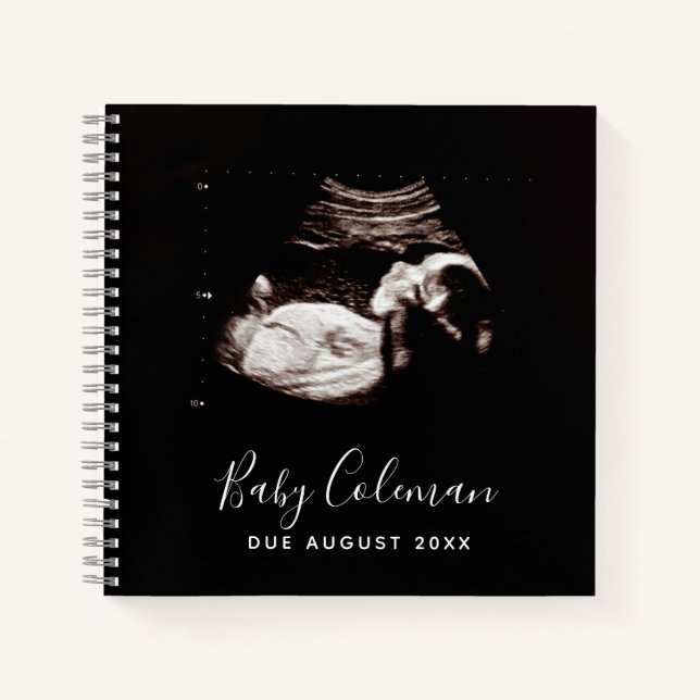 Baby Sonogram Personalized Memory Pregnancy Book (Front)