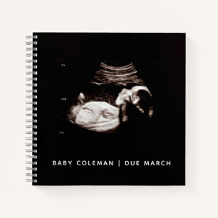 Baby Sonogram Personalized Memory Pregnancy Book