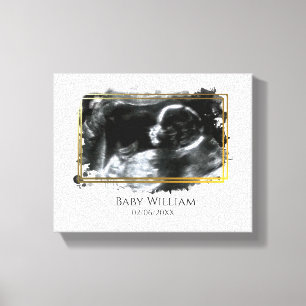 Baby Ultrasound Sonogram Picture Expecting Canvas Print