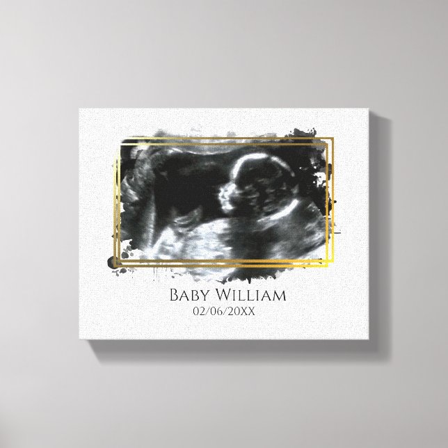 Baby Ultrasound Sonogram Picture Expecting  Canvas Print (Front)
