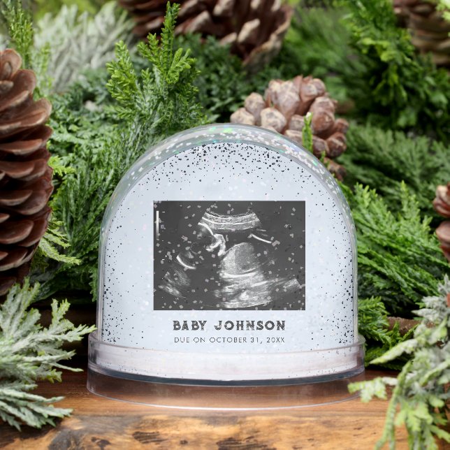 Baby Ultrasound | Sonogram Pregnancy Announcement Snowglobe (Winter)