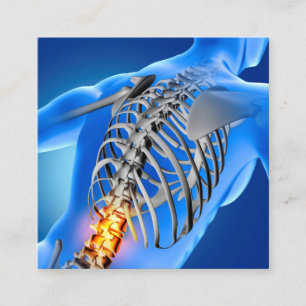 Back Pain Photo Graphic Square Chiropractic Business Card